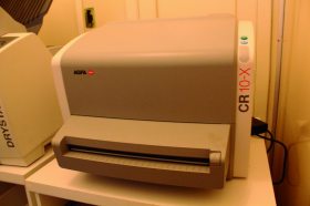 Equipamento de Raios-X digital j� est� funcionando no Hospital S�o Salvador